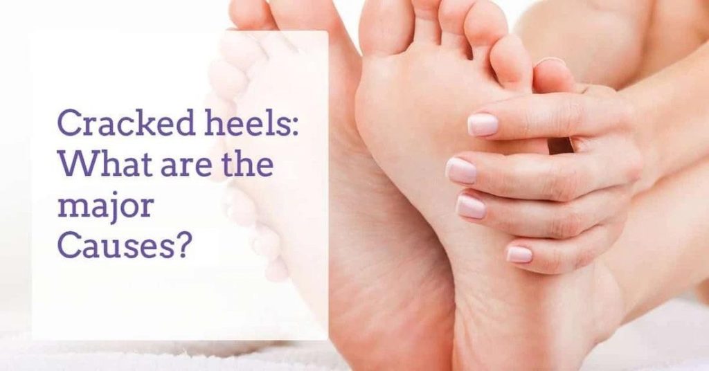Amazon.com : Dr. Frederick's Original Moisturizing Gel Socks - 4 Pieces -  Prevents Dry Cracked Heels & Cracked Feet - Day & Night Socks - W4-10 |  M5-8 : Beauty & Personal Care